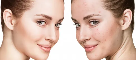 هورمون استروژن و پروژسترون چیست؟ همه چیز درباره افزایش و کاهش و تفاوت ان ها