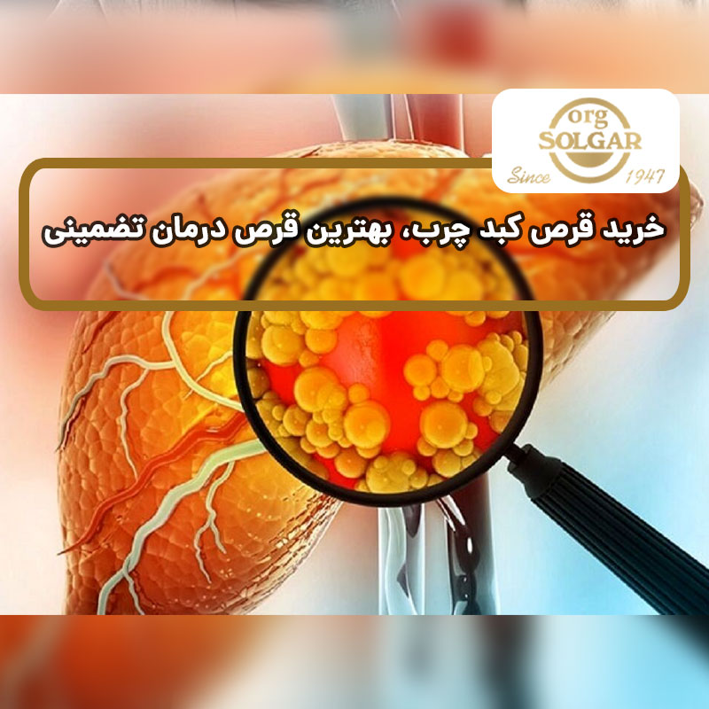 خرید قرص کبد چرب