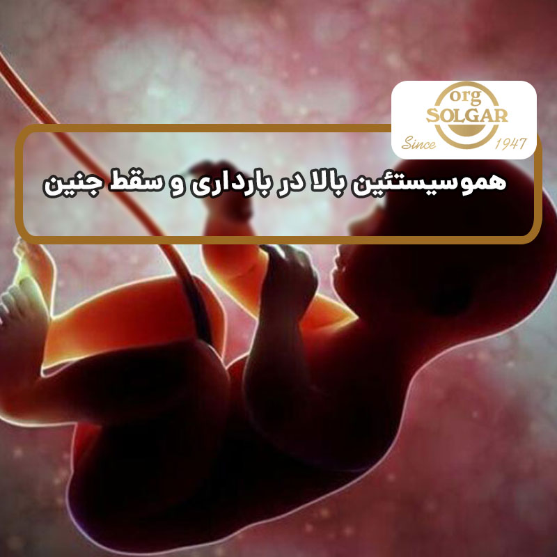 هموسیستئین بالا در بارداری و سقط جنین
