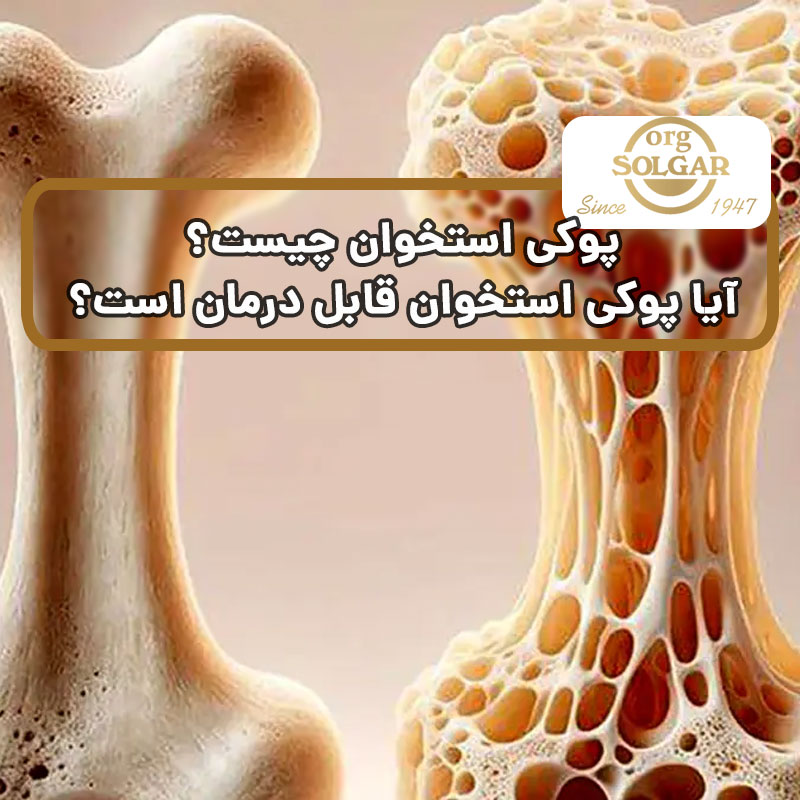 پوکی استخوان چیست؟ آیا پوکی استخوان قابل درمان است؟
